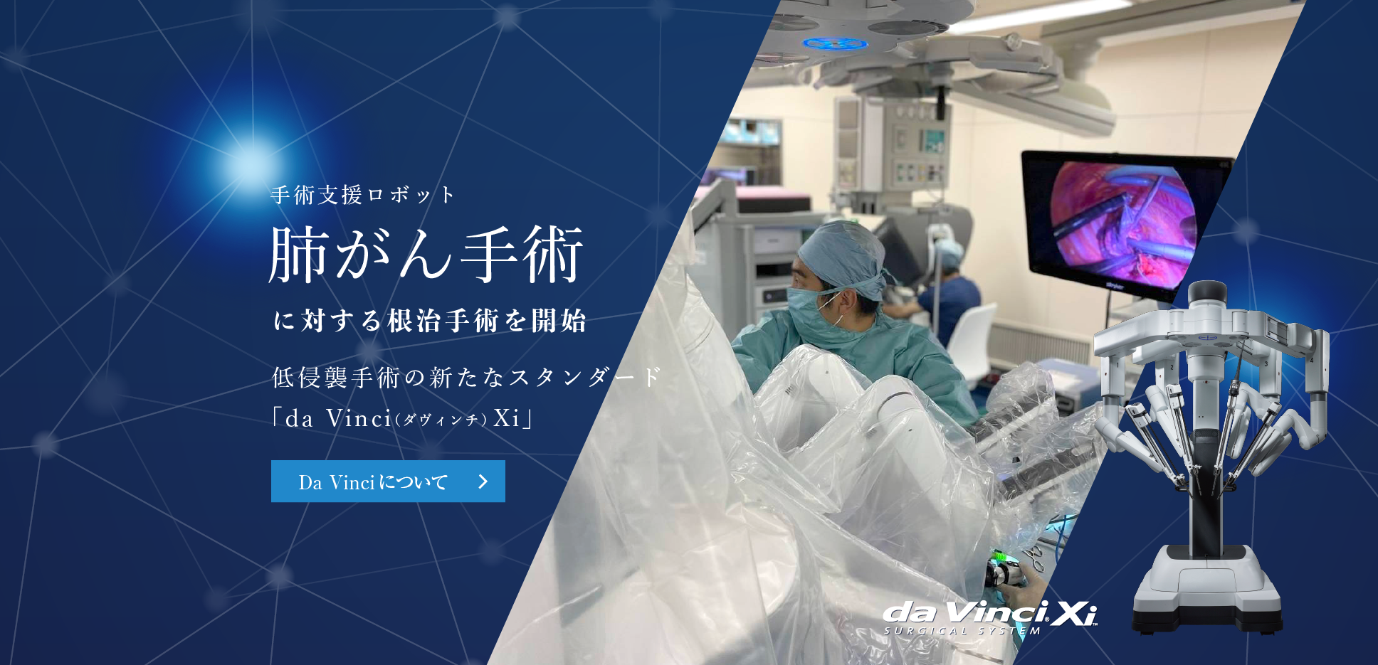 手術支援ロボット　肺がん手術に対する根治手術を開始　低侵襲手術の新たなスタンダード「Da　Vinci（ダヴィンチ）Xi」