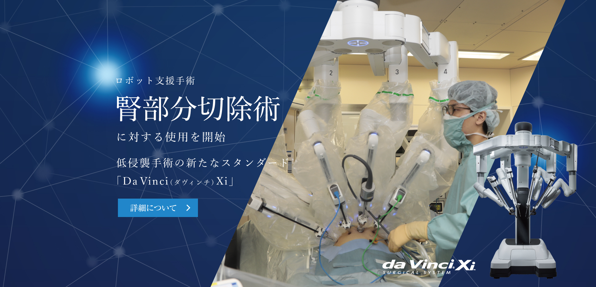 手術支援ロボット　腎部分切除術に対する使用を開始　低侵襲手術の新たなスタンダード「Da　Vinci（ダヴィンチ）Xi」