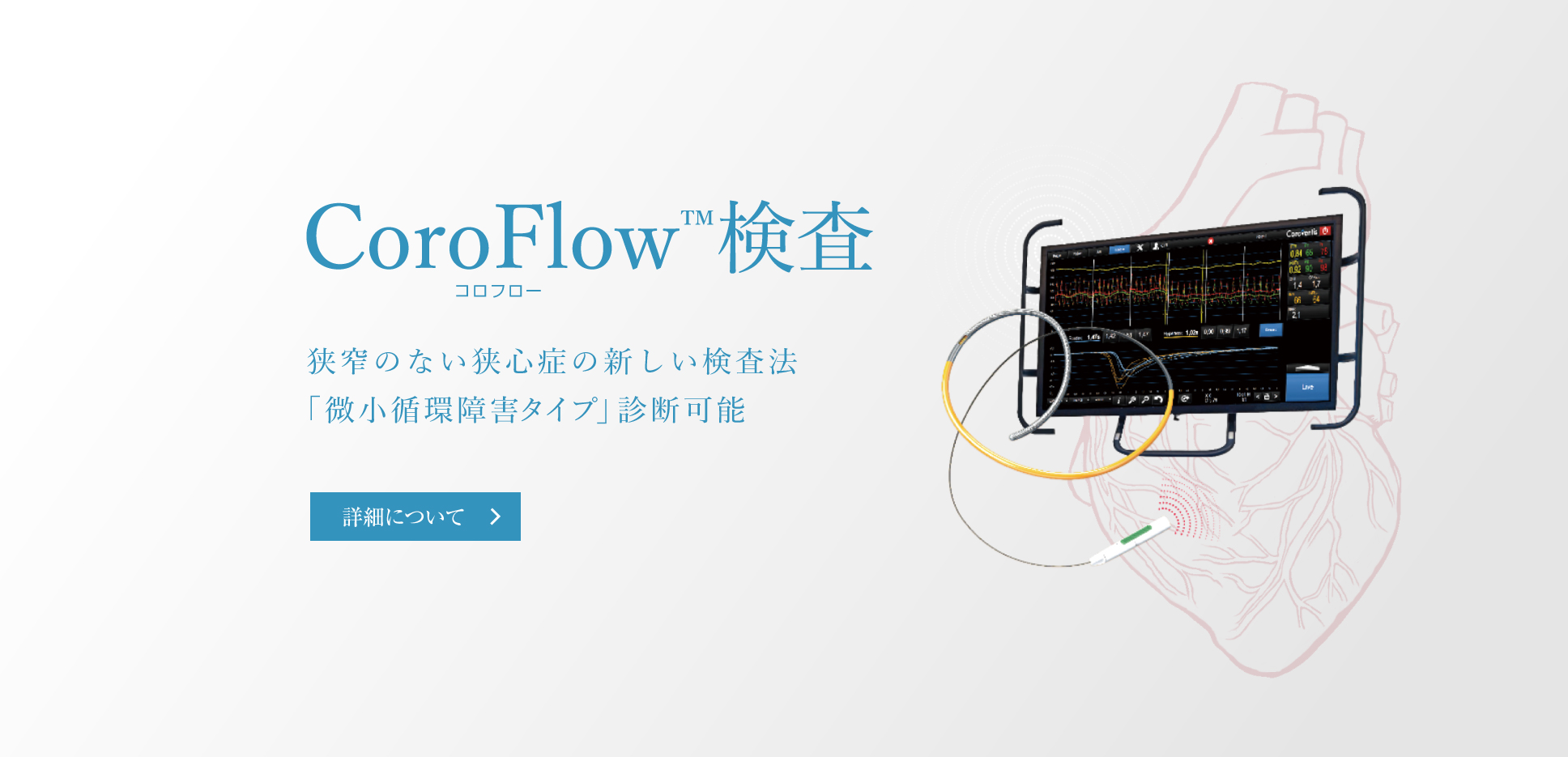 CoroFlow検査　狭窄のない狭心症の新しい検査法　「微小循環障害タイプ」診断可能