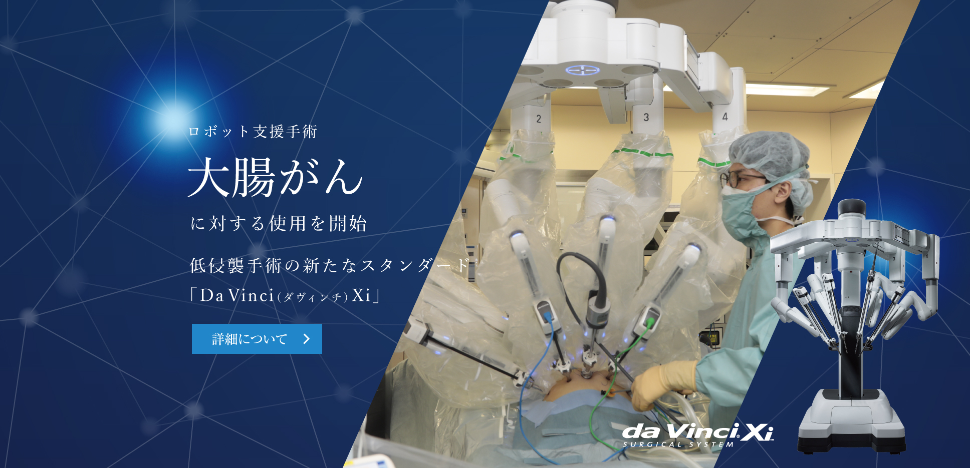 手術支援ロボット　大腸がんに対する使用を開始　低侵襲手術の新たなスタンダード「Da　Vinci（ダヴィンチ）Xi」